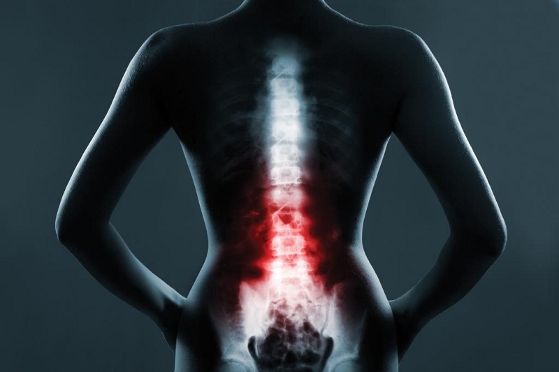 Exercises To Strengthen Your Back Muscles At Home